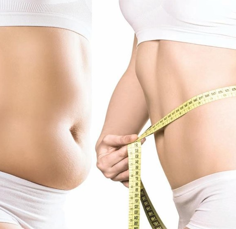 Body Shaping Surgeries